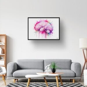 dream watercolour cerebral angiography side lobby
