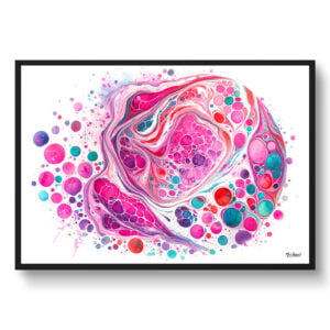 Micrograph of follicular thyroid carcinoma circular Wall Art Print Watercolour Endocrine System Medical Doctor Clinic Painting