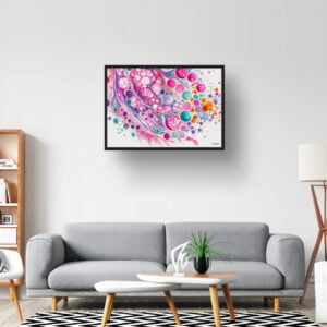 dream watercolour micrograph of follicular thyroid carcinoma lobby