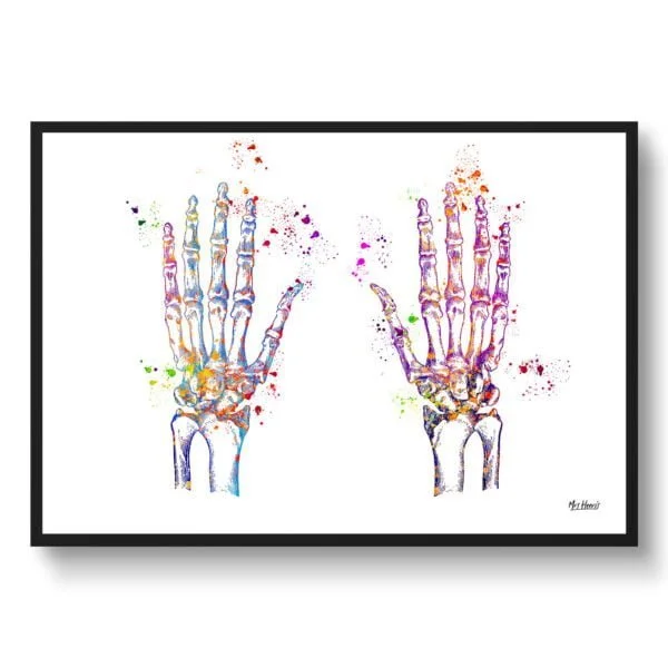 Hand Bones Anatomy Wall Art Print Watercolour Hand Surgeon Medical Doctor Office Clinic Framed Painting