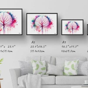 dream watercolour cerebral angiography back print size comparison