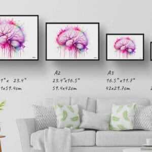 dream watercolour cerebral angiography side print size comparison
