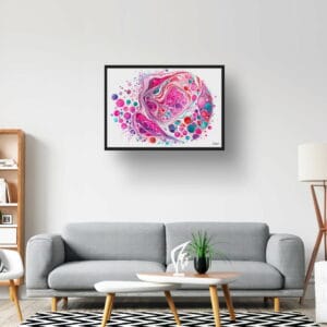 dream watercolour micrograph of follicular thyroid carcinoma circular lobby