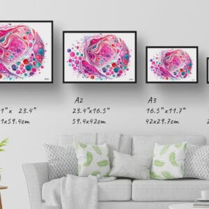 dream watercolour micrograph of follicular thyroid carcinoma circular print size comparison