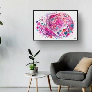 dream watercolour micrograph of follicular thyroid carcinoma circular waiting room 1