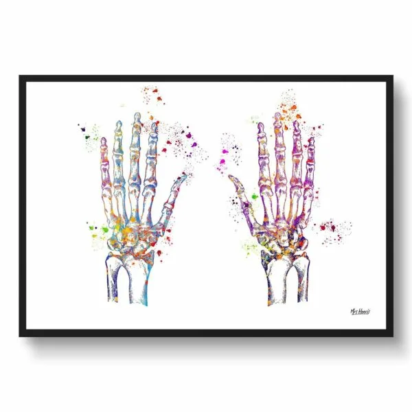 Hand Bones Anatomy Wall Art Print Watercolour Hand Surgeon Medical Doctor Office Clinic Framed Painting - Image 5