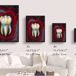 dental nocturne molar print size comparison