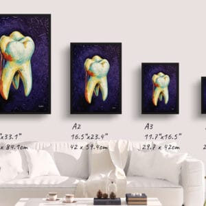 dental van gogh molar print size comparison